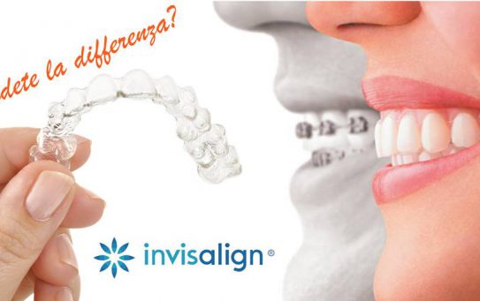 Invisalign