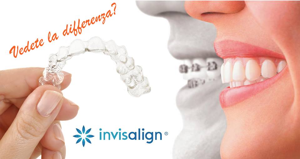 Invisalign