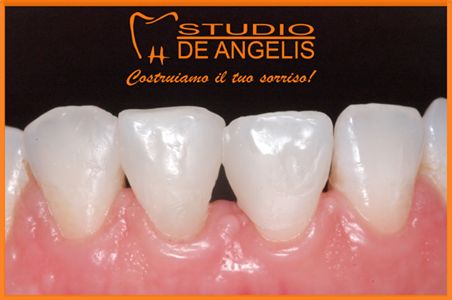 Volete vedere come COSTRUIAMO IL VOSTRO SORRISO?